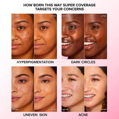 Before and after results showing Too Faced Born This Way Super Coverage Concealer covering hyperpigmentation, dark circles, uneven skin, and acne