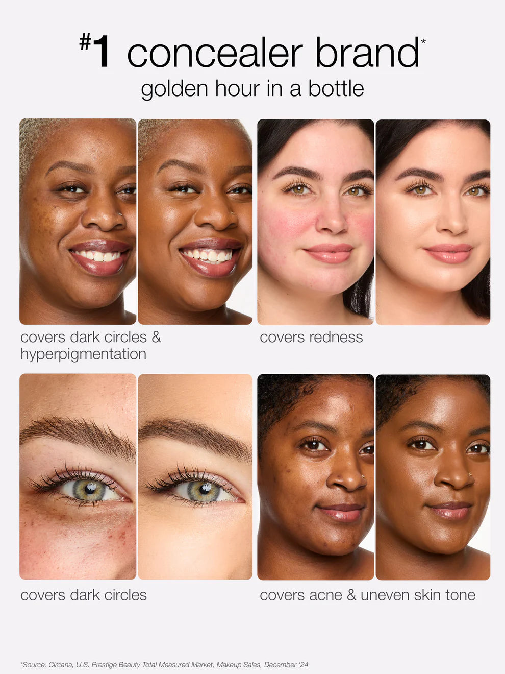 Tarte Shape Tape Radiant Concealer before and after results on different skin concerns