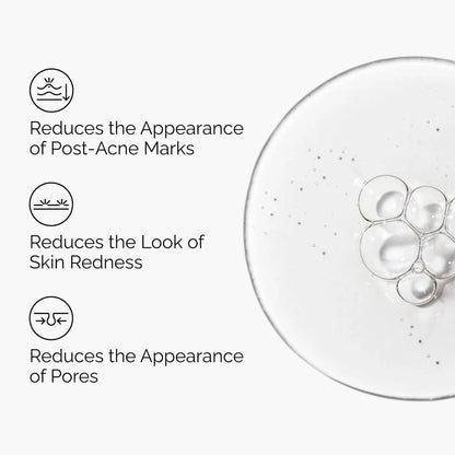 صورة توضيحية لفوائد The Ordinary Aloe 2% + NAG 2% Solution للمساعدة في تقليل مظهر آثار ما بعد الحبوب والاحمرار والمسام