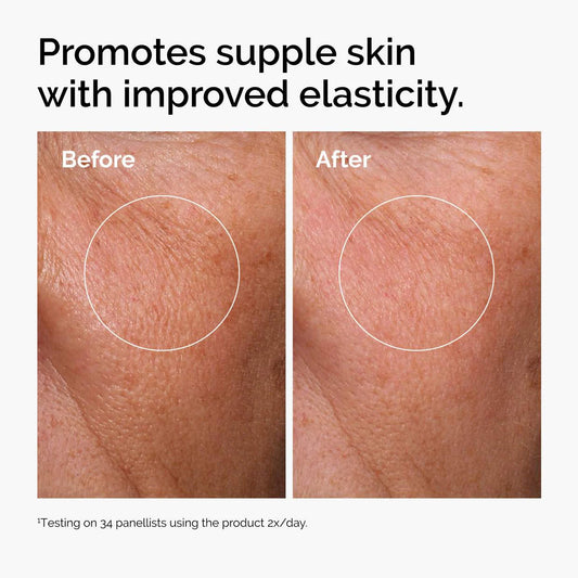 مقارنة قبل وبعد على البشرة بعد استخدام The Ordinary Hyaluronic Acid 2% + B5 للمساعدة في تحسين مرونة البشرة
